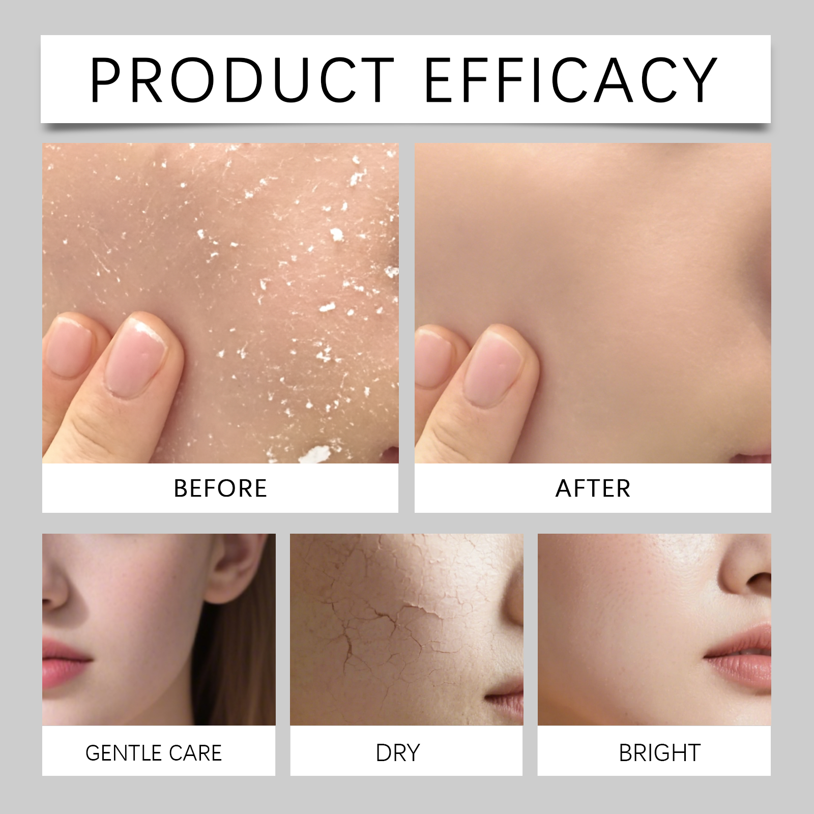 80ml Hydrating Mist for Anti D - Luxury Natural Skincare reseña y precio